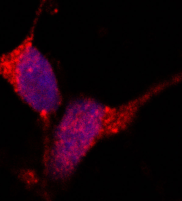 Microscopic image of stress granules (red) filling stem cell-derived neurons (nuclei shown in blue)